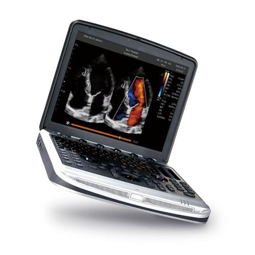 women's health ultrasound